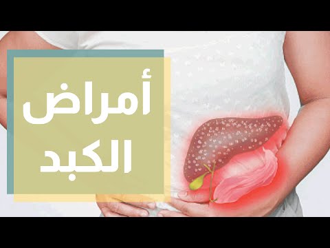 أمراض الكبد وتشخيصها وعلاجها