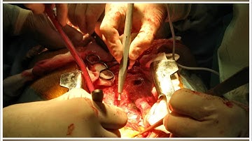 Heart Operation PowerPoint Presentation Template - TheTemplateWizard.com