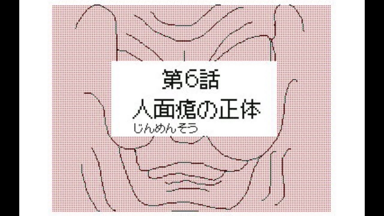 うごメモ鬼太郎第6話 人面瘡の正体 Youtube