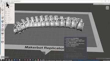 CT or MRI to 3D print  DICOM to STL with Local computer Part 2 of 2