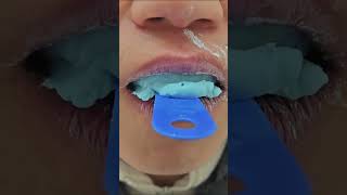 How To Make A Dental Impression At Home