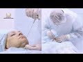 Как подтянуть овал лица?