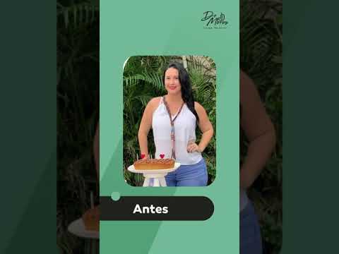 Bajar de peso sin cirugía es posible?