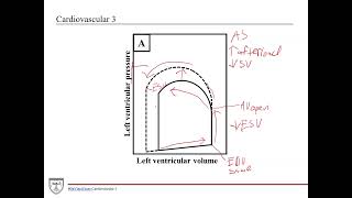 Increased Cardiac Contractility Pressure Volume Loop Explained