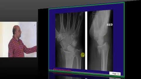 NEETPG Image based MCQ Mock Test Discussion 1648 Lec 02 Download uMedico App