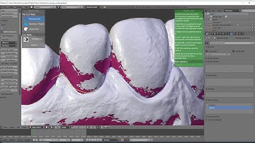 d3splint cast reduction hack