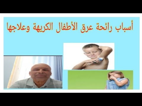 أسباب رائحة عرق الأطفال الكريهة وعلاجها