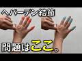 【へバーデン結節の治し方】痛み消失した。「ここ」を引っ張るだけ。
