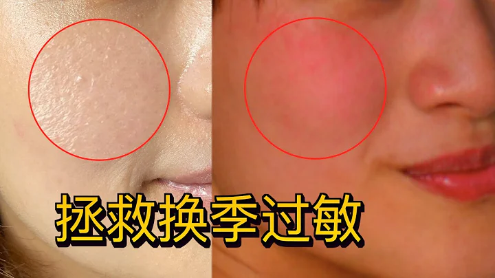 皮膚過敏了怎麼辦？幫你即決換季過敏 - 天天要聞