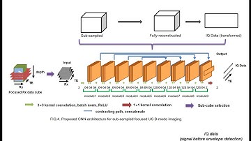 BiS987_Biofusion Seminar: Deep learning-based beamformer for ultrasound imaging (DeepBF)