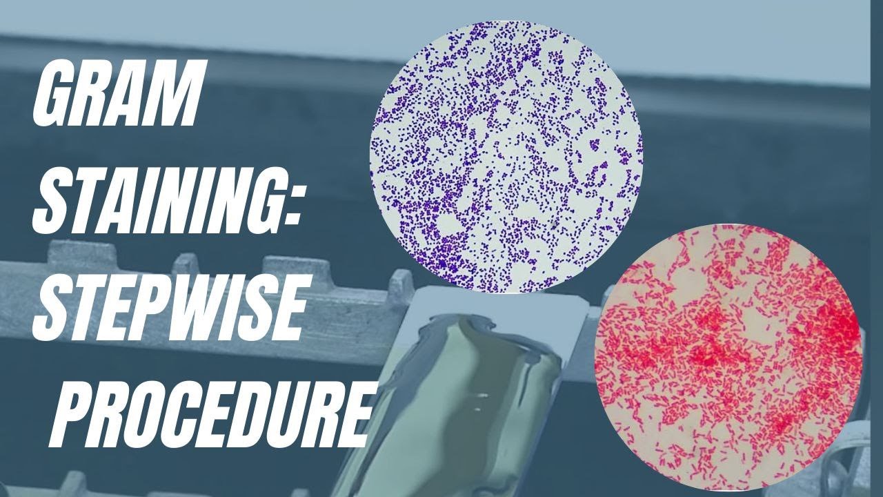 Gram Staining | Procedure and principle of gram staining | How to ...