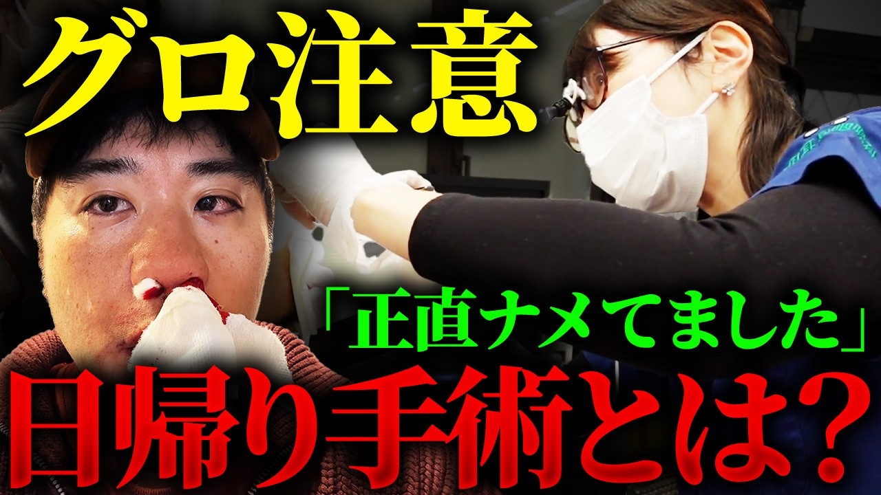 【閲覧注意】手術の流れをお見せします！これさえ見れば日帰り手術がわかる！