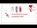 Thrombose veineuse profonde tvp