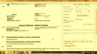 Uploading test results in Oscar   new way