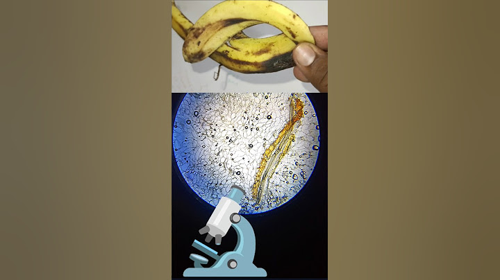 केले का छिलका microscope में कैसा दिखता हैं Banana peel #microscopevideo
