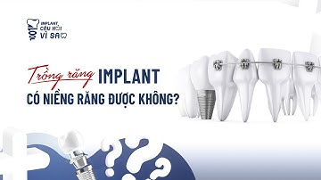 Trồng Răng Implant Có Niềng Răng Được Không? | ThS BS Phạm Hùng Sơn