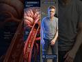 A Tiny Blood Clot Can Cause a Stroke 😳🧠#shorts