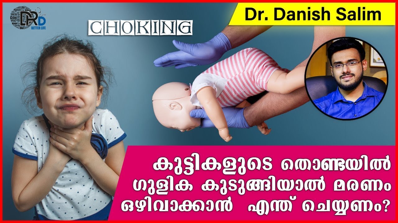 646:💊 തൊണ്ടയിൽ ഗുളിക കുടുങ്ങി കുട്ടി മരിച്ചു.എങ്ങനെ രക്ഷിക്കാം? How to save a child from Choking?