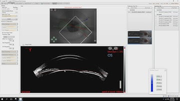 09 Insight 100 Tips for Better Scans