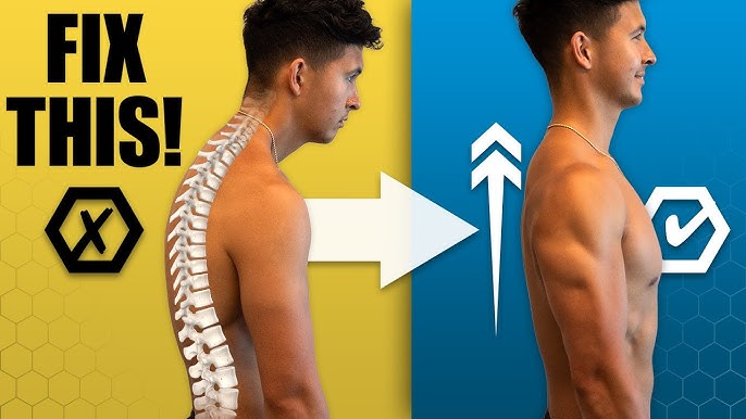How to Improve Bad Posture With Exercise