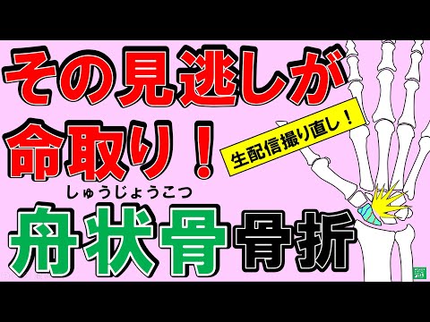 舟状骨骨折 撮り直し！20210915　＃柔道整復師　#接骨院　＃国家試験