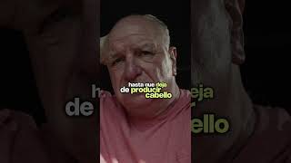 Lo que NO te contaron del FINASTERIDE para la caida del cabello #shorts