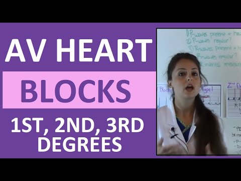 Video: 3 moduri de a identifica blocurile cardiace