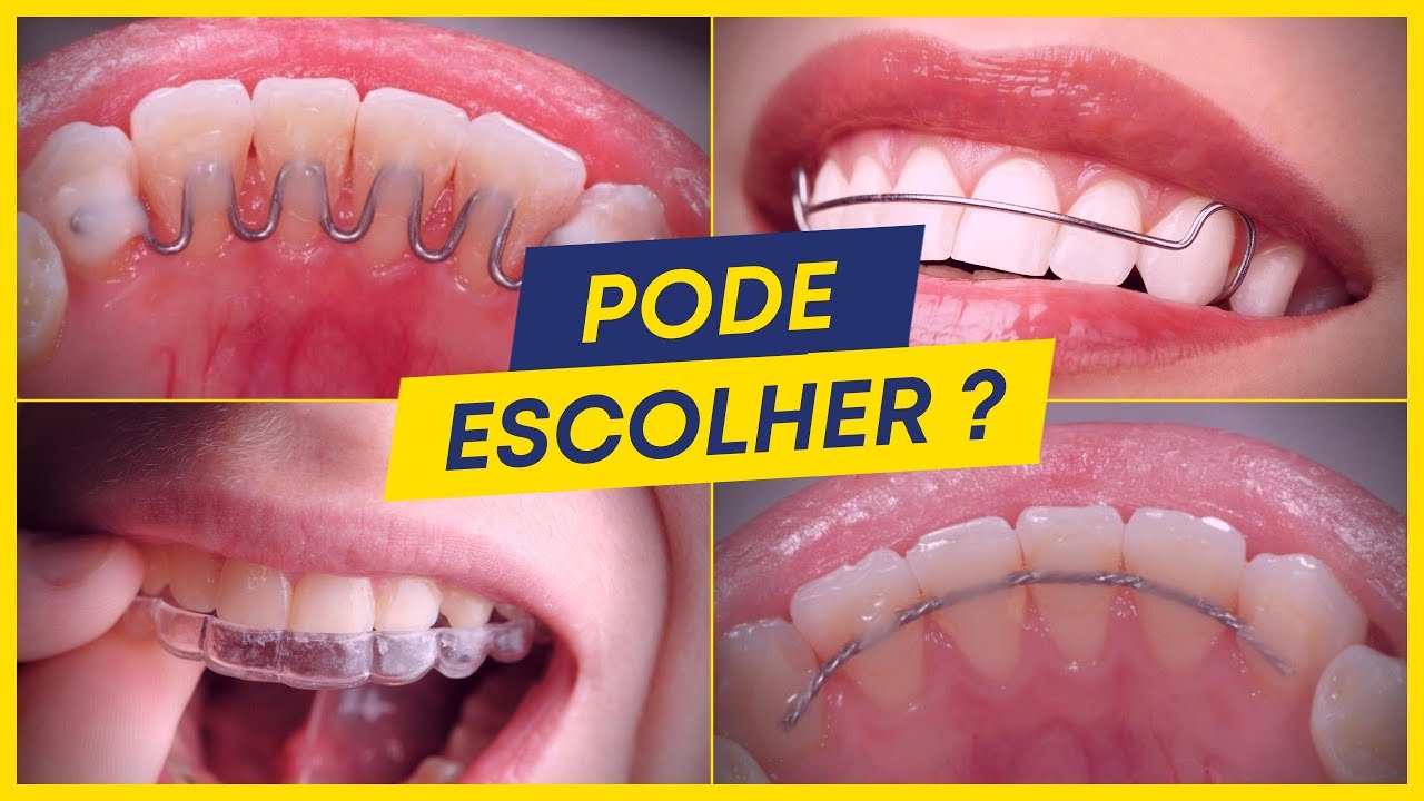 conten-o-ortod-ntica-est-tica-voc-j-ouviu-falar-lzrnn