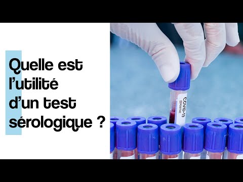 Quelle est l&rsquo;utilité d&rsquo;un test sérologique ?