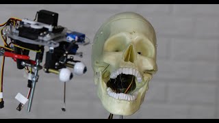 Eric gets a facelift part 1
