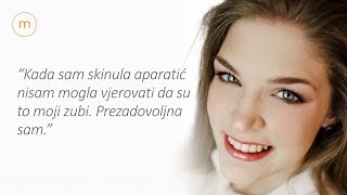 Ortodoncija Marelić - Prikaz Slučaja Valnea F. - Ortodontski Fiksni Aparatić