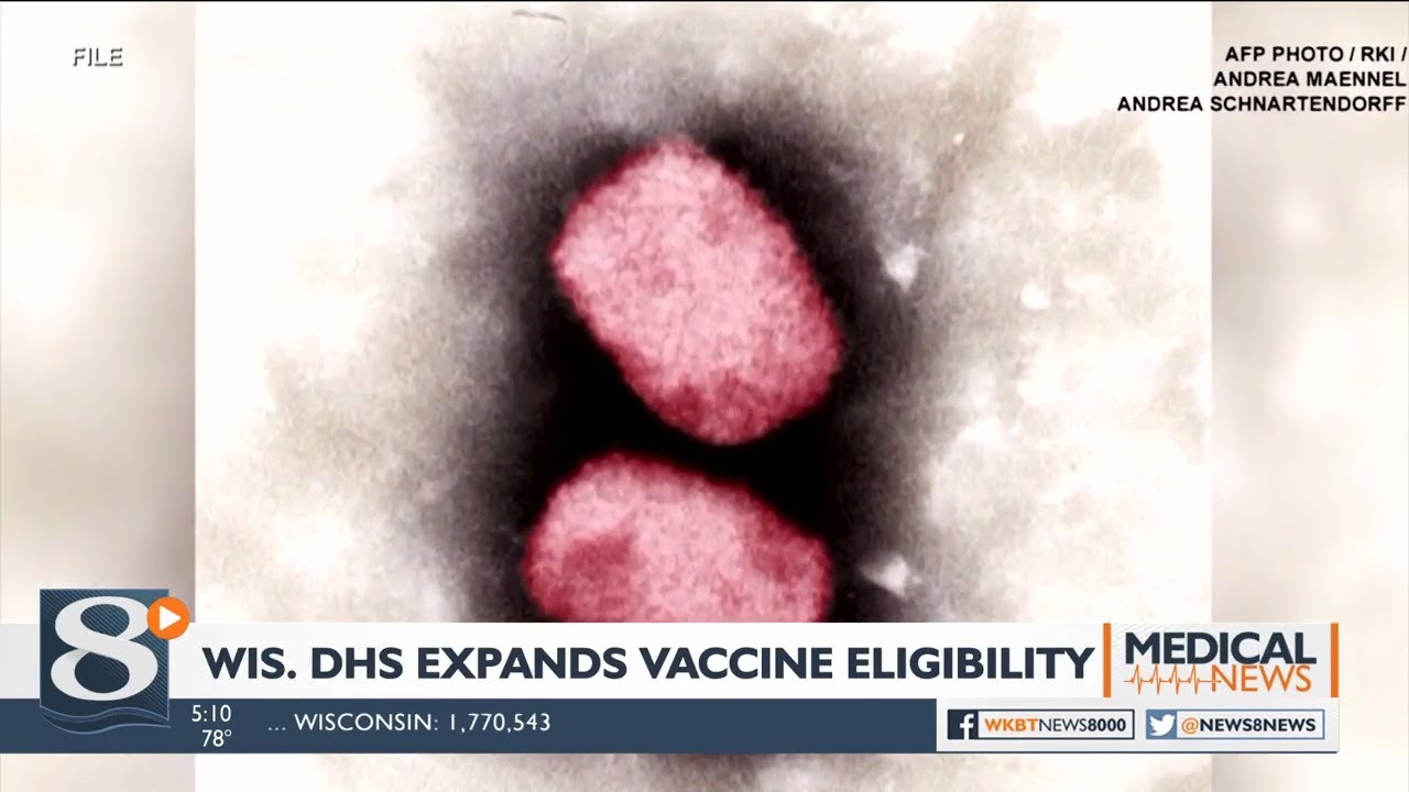 Eligibility expanded for monkeypox vaccine in Wisconsin