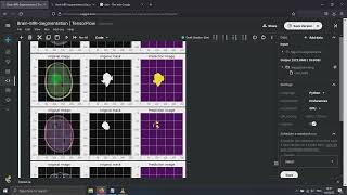 Unet segmentation demo