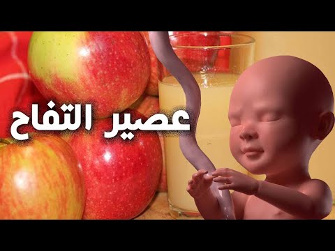 هل تعلم ما يحدث للجنين والام عند تناول عصير التفاح اثناء الحمل ؟