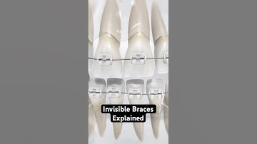 Invisible Braces Explained (3D Animation)