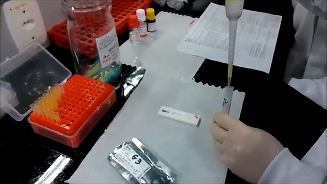 HBsAg (Ag de superficie)PRUEBA RAPIDA HEPATITIS "B" YouTube