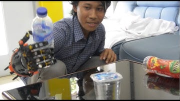 Open Source Hand Prosthetic Based 3D Printer - iDIG Lab. Despro ITS