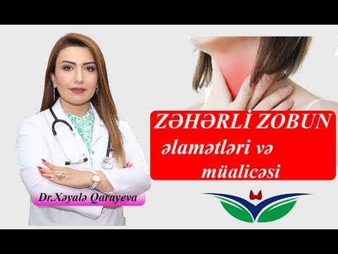 Zəhərli zobun əsas əlamətləri və müalicəsi Dr.Xəyalə Qarayeva