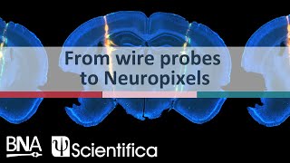 Celebrity From wire probes to Neuropixels: Advancements in neurophysiology multielectrode recording techniques Net Worth