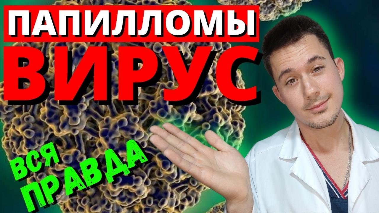 ВПЧ | Вирус папилломы человека | Лечение | Удаление папиллом - YouTube