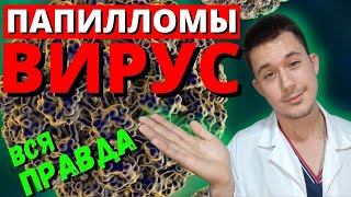 ВПЧ | Вирус папилломы человека | Лечение | Удаление папиллом