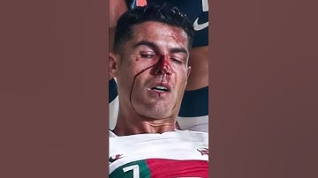Ronaldo’s Serious Car Accident #shorts