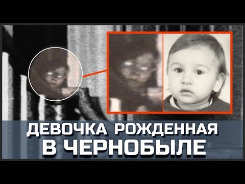 видео: Девочка рожденная в Чернобыле