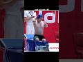 How Hand Transplant Works 😱 #shorts #viral #trending #youtubeshorts #facts #shortsvideo #shots #fypシ