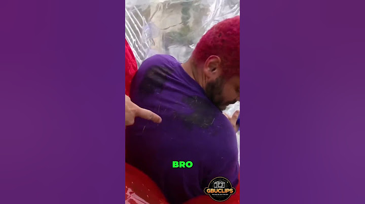 Erobb falls into dog poop! #shorts #live #fail #livestream #fails #funny #otk