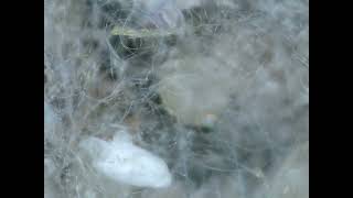 Spider Egg Sac Part 3 Ready To Emerge Steatoda Triangulosa