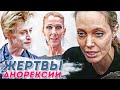 Знаменитости, которые похудели до безобразия. Похудевшие звезды шоу бизнеса. #Похудевшиезведы