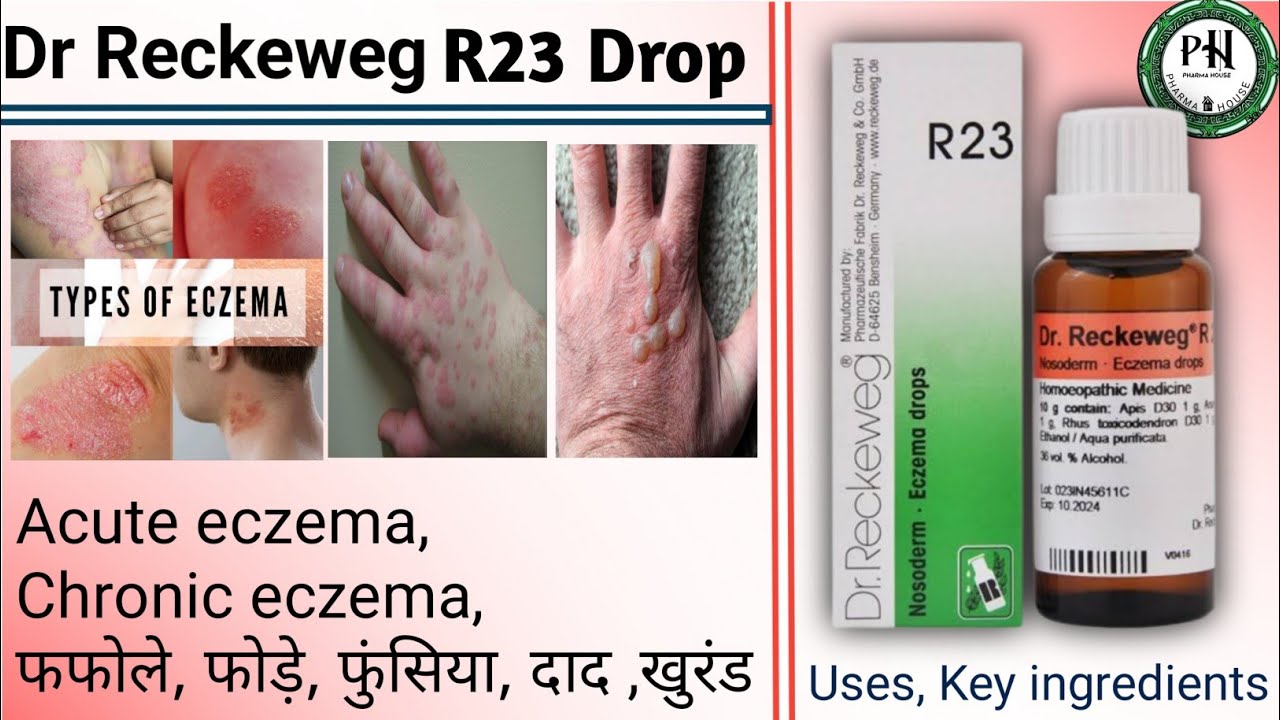 Dr Reckeweg R23 Drop Uses In Hindi Eczema Drop Benefits Eczema dr-reckeweg-r23-drop-uses-in-hindi-eczema-drop-benefits-eczema