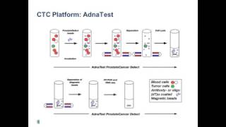 2017 IPCR Video: Circulating Tumor Cells and DNA