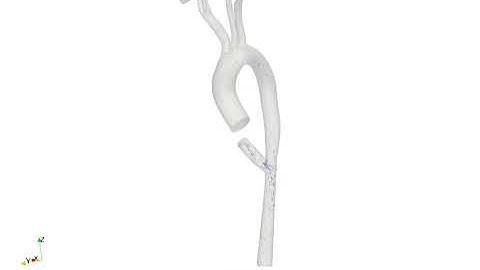 CFD Sim # 16 - Velocity Vectors - Model 2: LAUD, with venturi 50% - CO = 3.5 L/min, LAUD = 1.5 L/min